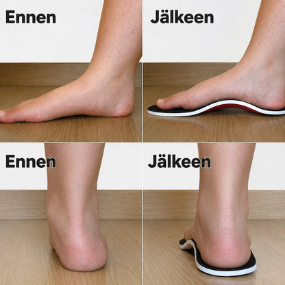 NordicStep™ - Pohjalliset kaarituella